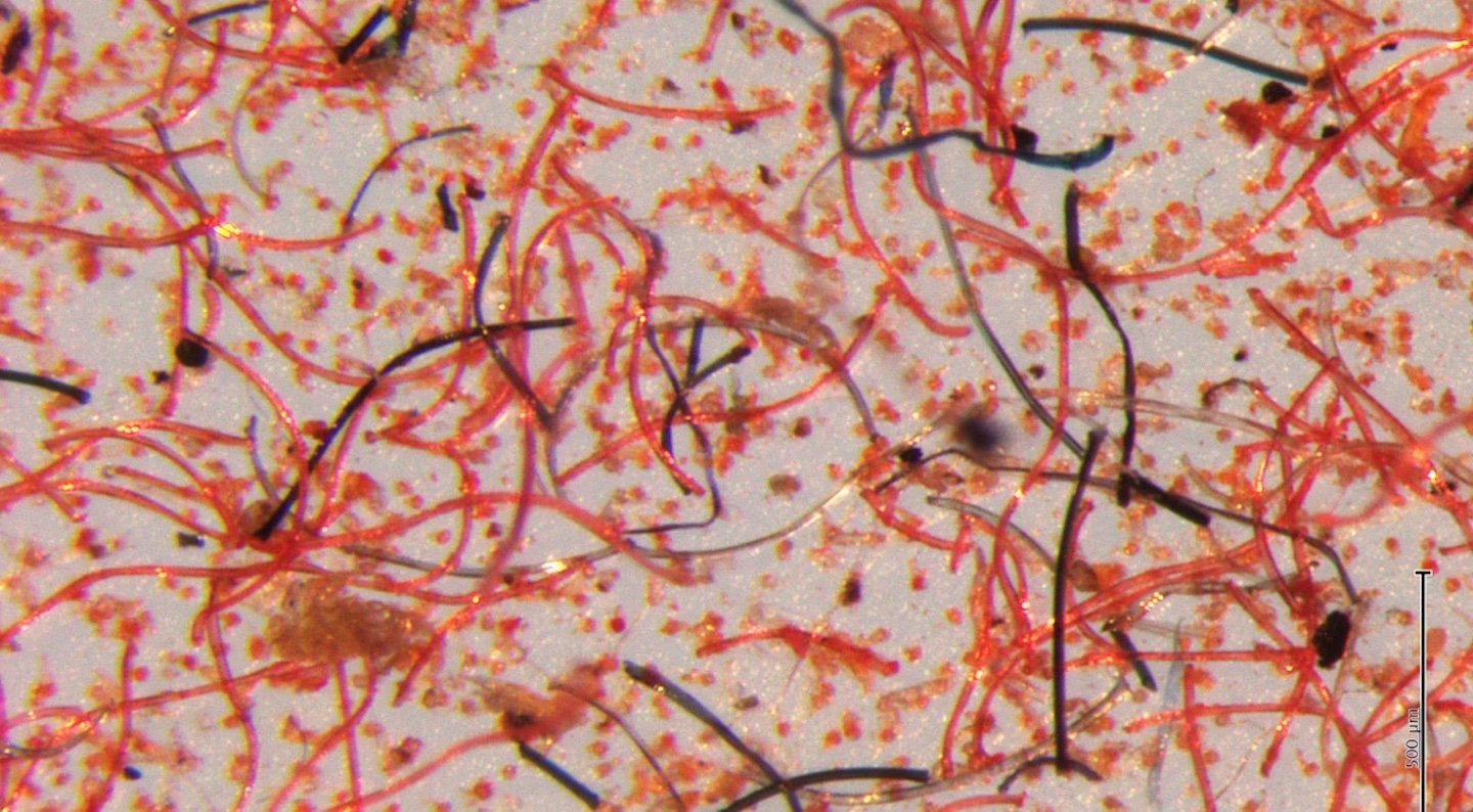 Microfibers under microscope
